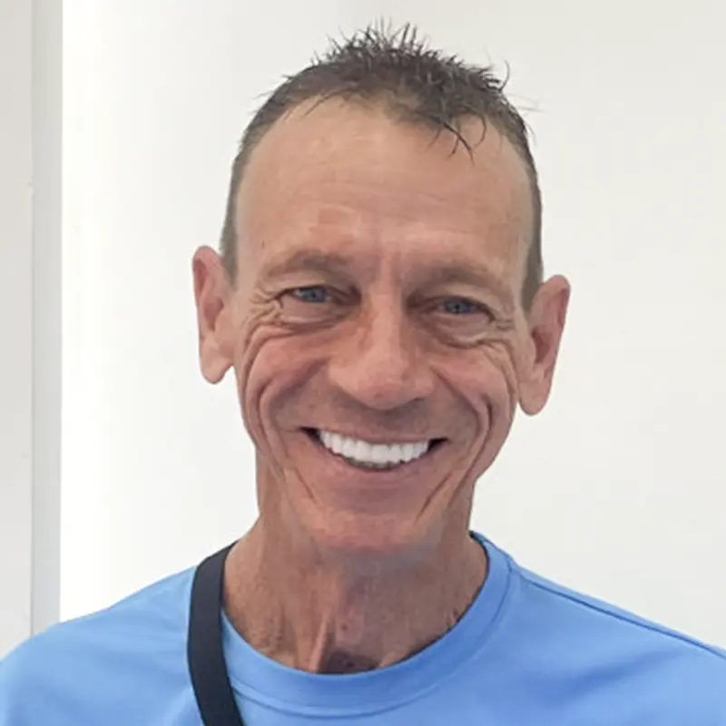 Mr. Bevis had his entire jaw covered with Emax porcelain veneers