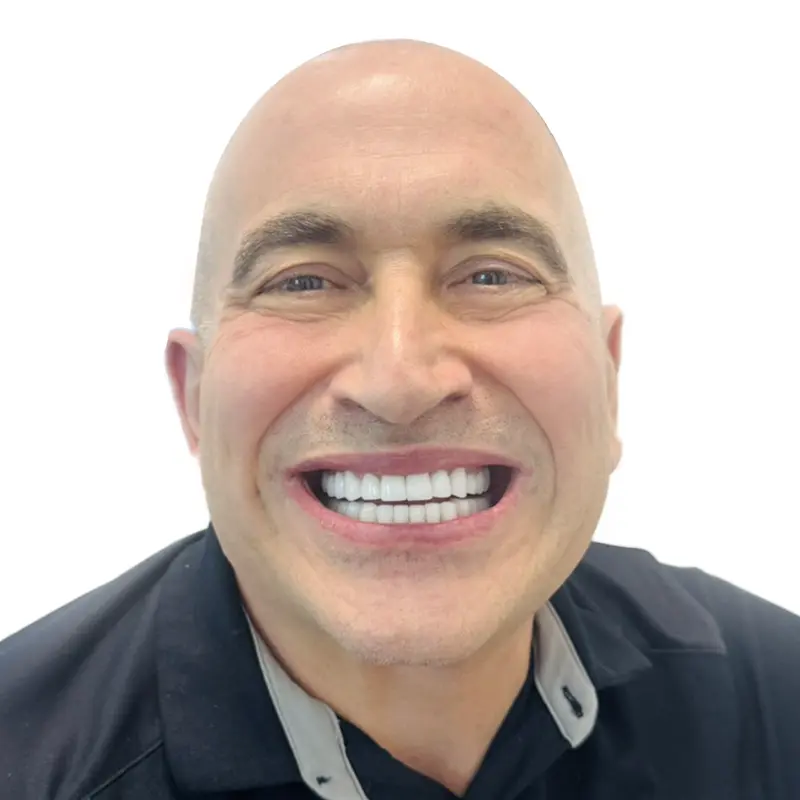 Mr. Franklin had 24 porcelain veneers applied