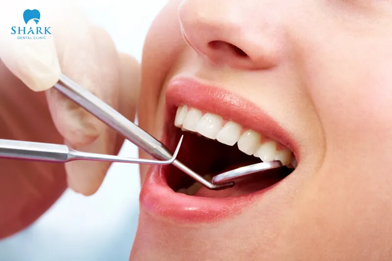 Tooth extraction is a minor dental surgery used to remove infected teeth