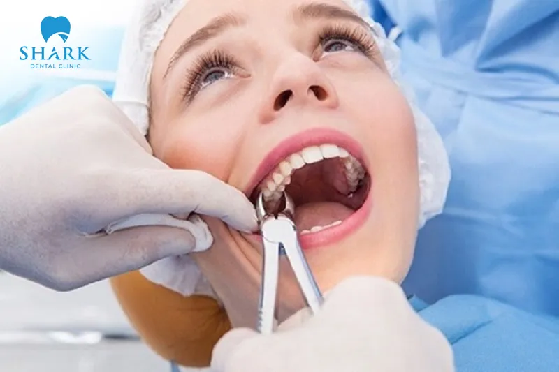 After administering anesthesia, the dentist performs the tooth extraction procedure