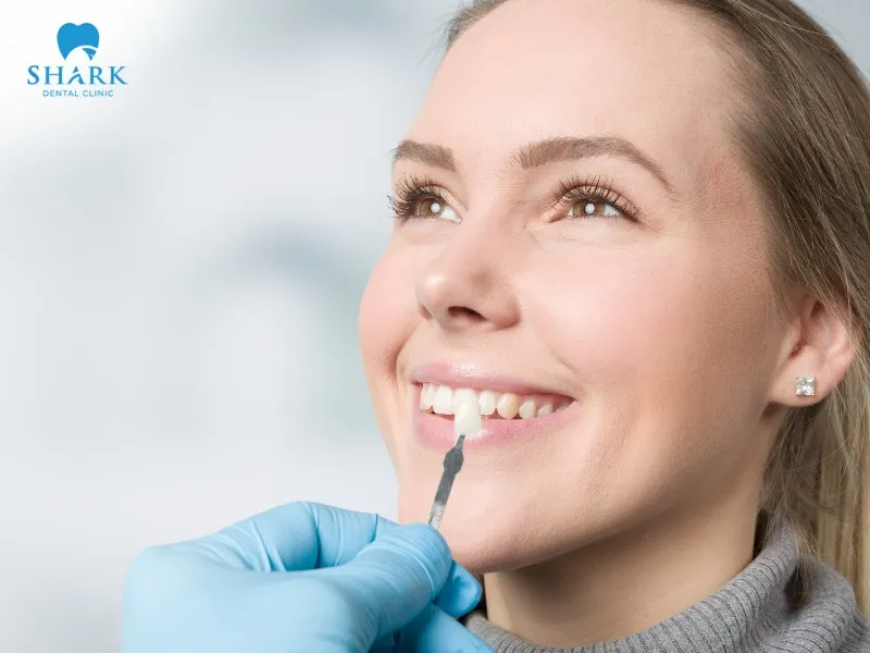 The veneer application method offers high aesthetics and is minimally invasive to natural teeth, but it is not suitable for severely crooked teeth.
