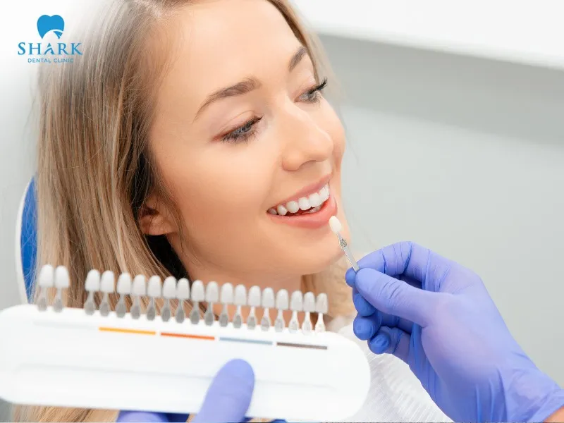 Before applying veneers, patients undergo a comprehensive oral health examination and receive advice on selecting the most suitable type of veneer.