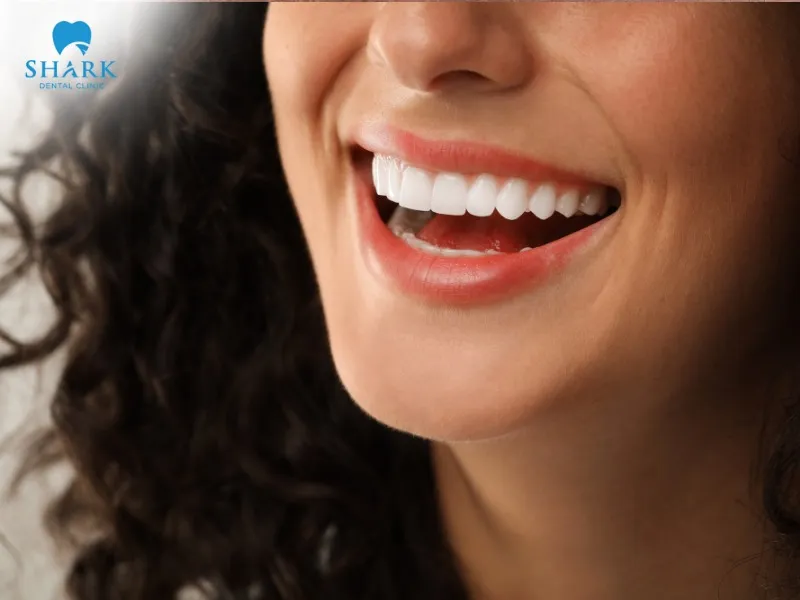 After getting veneers, patients should follow oral care instructions and attend follow-up visits as scheduled.