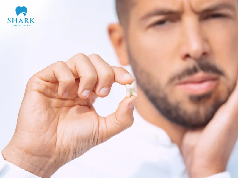 Additional costs may include consultation, X-rays, and post-extraction care