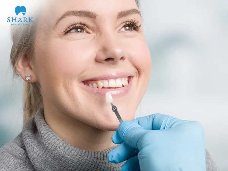 Porcelain veneers are commonly used to improve imperfections such as tooth discoloration, yellowing, and decay