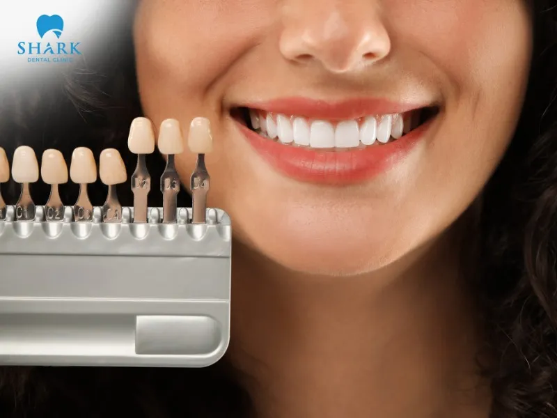 The application of veneers at dental clinics offers numerous benefits in terms of both cosmetic results and aesthetics, making it a favored choice among those who prioritize their appearance