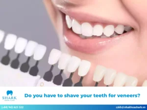 Do you need to shave teeth for Veneers?