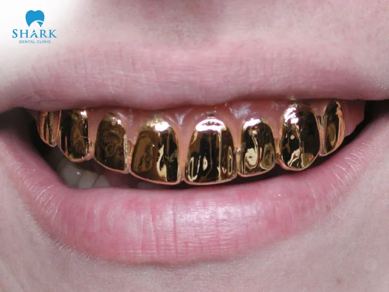 Gold dental crowns offer key advantages such as excellent orthodontic effectiveness, high durability, and long-lasting lifespan.