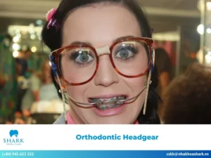 Headgear braces