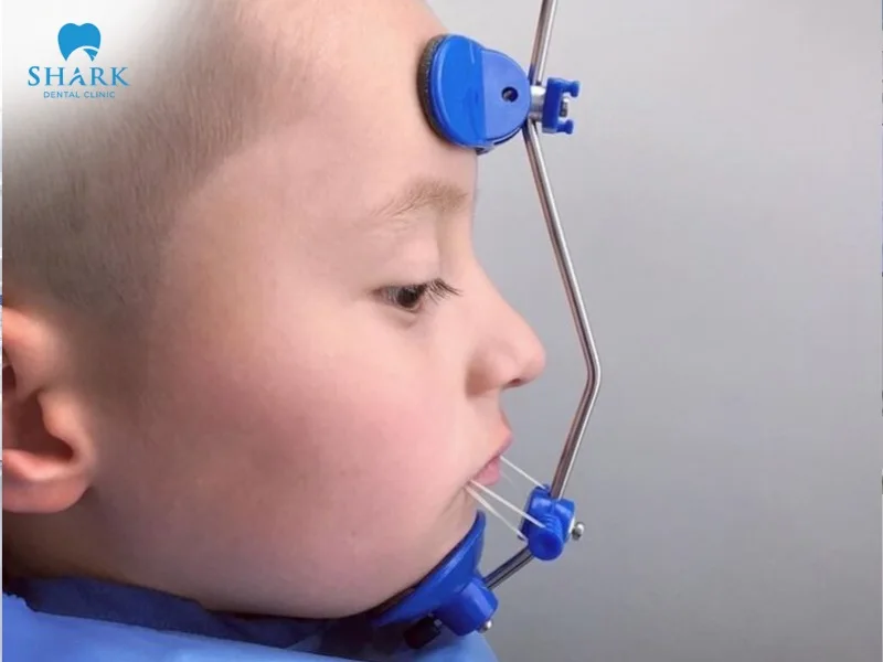 Children are encouraged to wear headgear for braces as early as possible