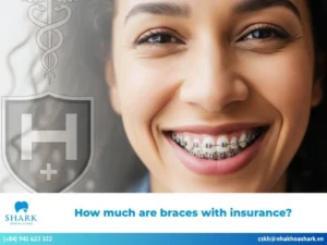 How much are braces with insurance