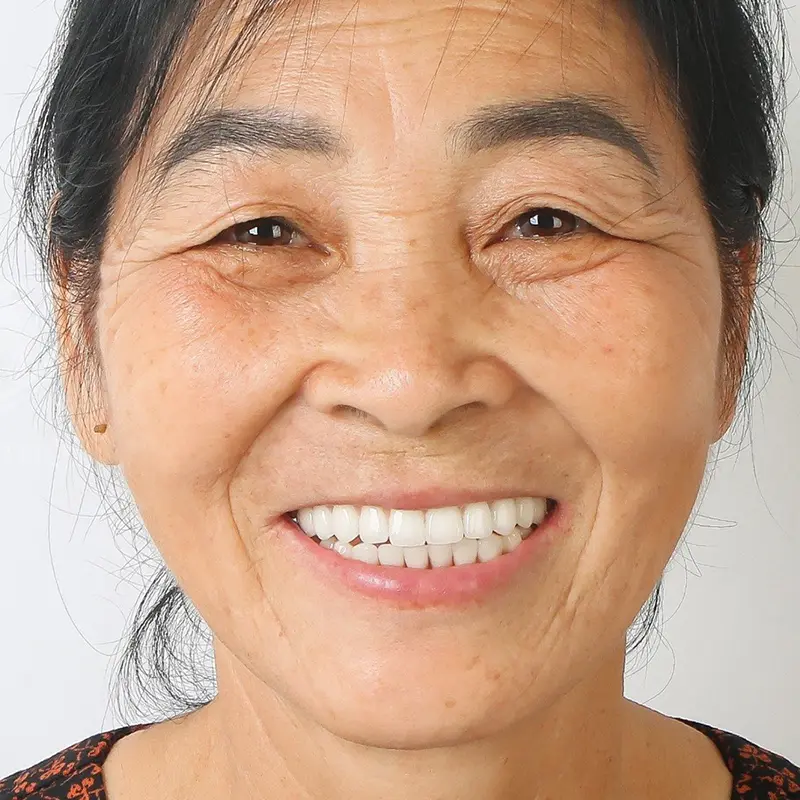 Ms. Mai had All on 4 dental implants