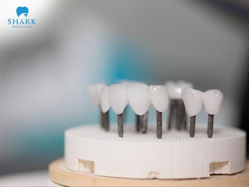 Zirconia dental crowns have a durable structure and are highly rated for both orthodontic effectiveness and aesthetics