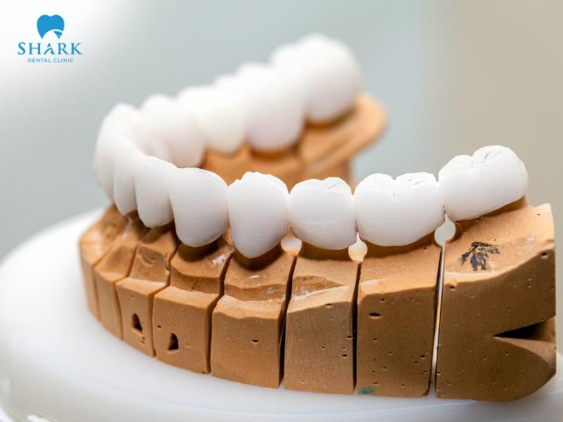 Zirconia crowns offer outstanding dental restoration results, though their price is slightly higher compared to traditional crown types