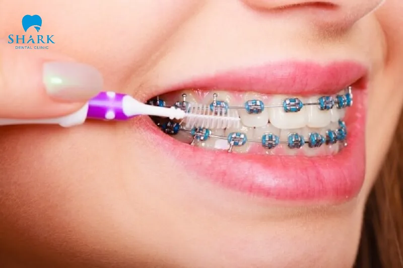 Pay close attention to proper and regular oral hygiene and dental care