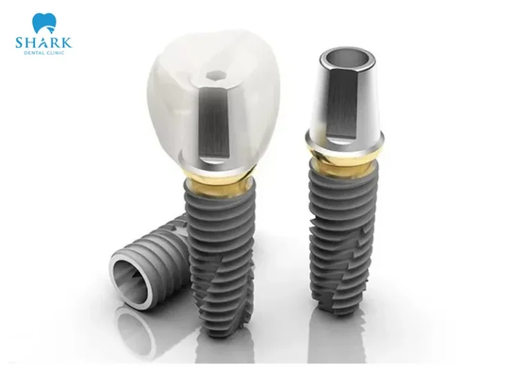 Every implant post has specific characteristics related to its structure and function