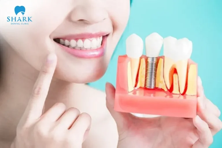 Maintaining proper oral hygiene and care is crucial after implant placement