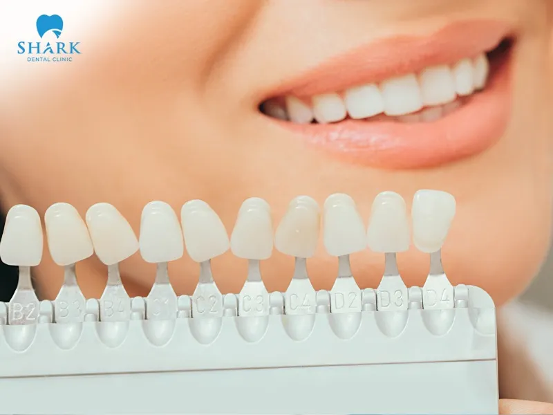 To extend the lifespan of porcelain crowns, you should address any oral health issues before restoration