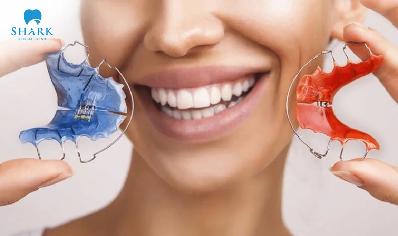 Proper care and cleaning of retainers after braces are essential