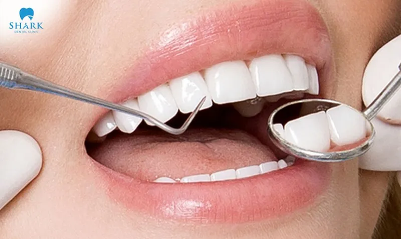 Porcelain fused to metal crowns can correct various dental imperfections.