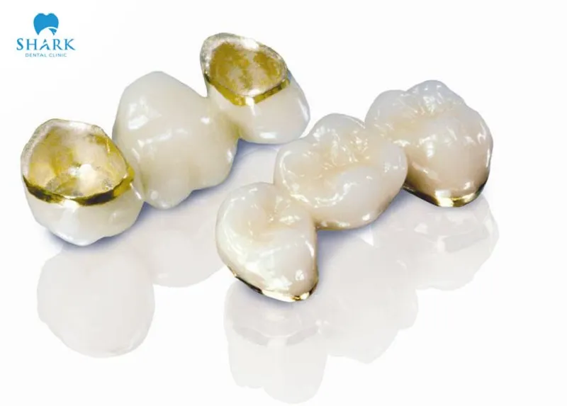 Porcelain fused to metal crowns are highly regarded for their durability and aesthetic effectiveness.