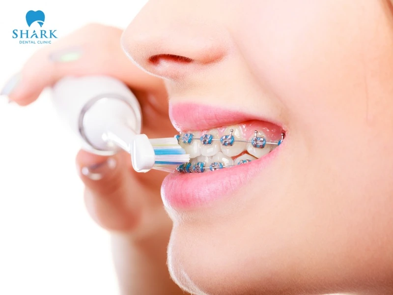 A regular toothbrush for people with braces has a rounded head, is easy to use, affordable, and suitable for many users