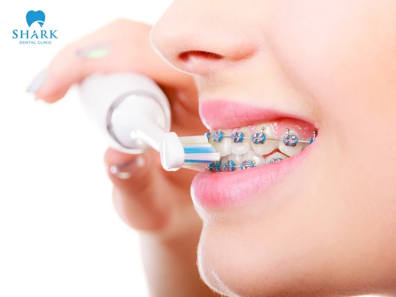 After eating popcorn, you should carefully brush your teeth and clean your mouth with an electric toothbrush or a soft-bristled toothbrush