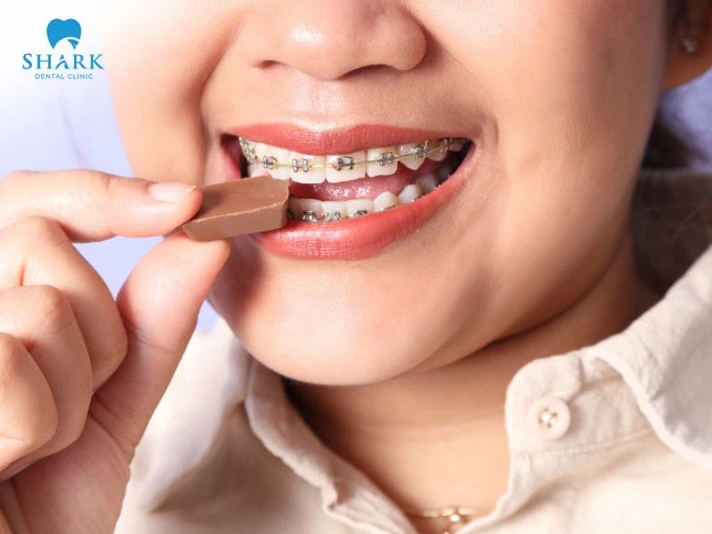 People with braces should pay attention to maintaining a scientific and healthy diet as advised by their orthodontist