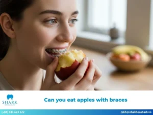 Can you eat apples with braces