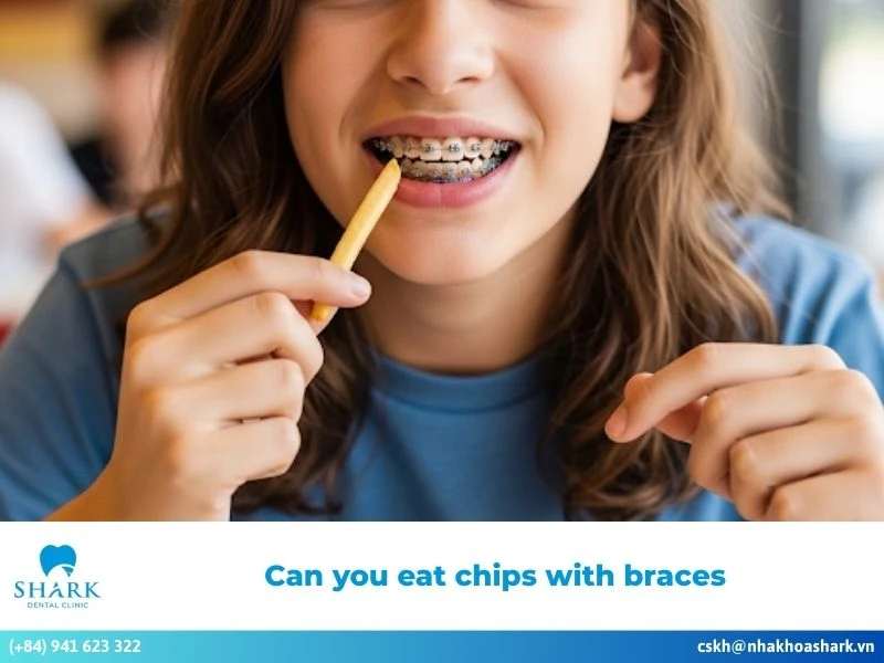 Can you eat chips with braces