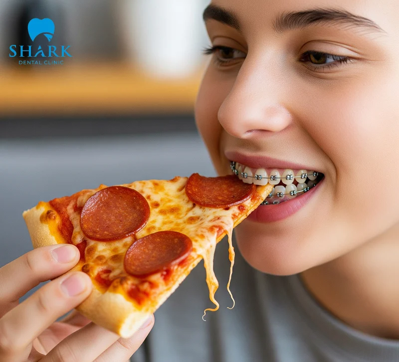 Eating too much pizza with braces can cause brackets to come loose or even break the orthodontic appliances