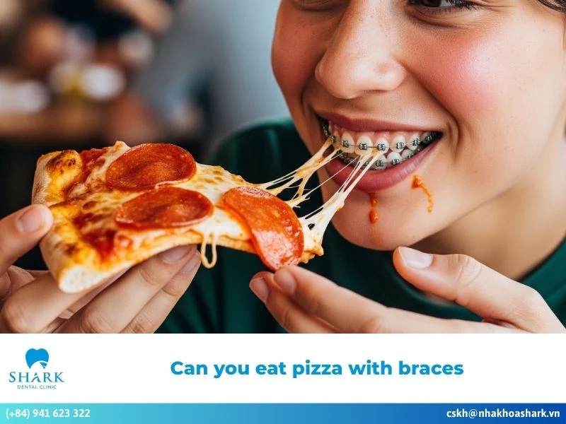 Can you eat pizza with braces