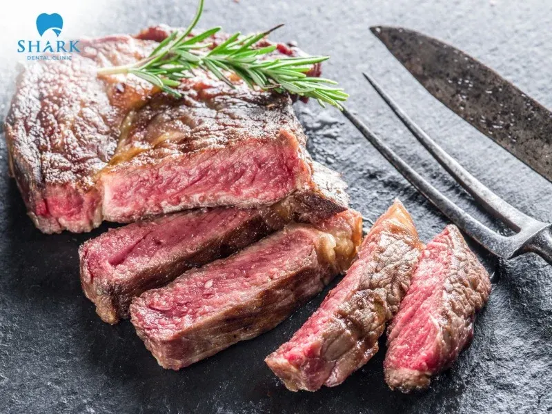 People with braces can still eat steak, but it should be limited, especially during the early stages of orthodontic treatment