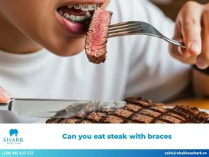 Can you eat steak with braces