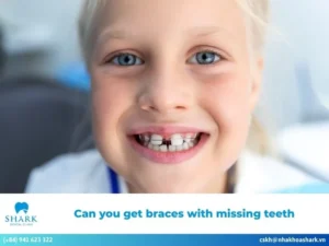 Can you get braces with missing teeth