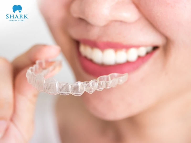 Clear braces can be applied for cases of missing teeth as long as the jawbone structure is stable