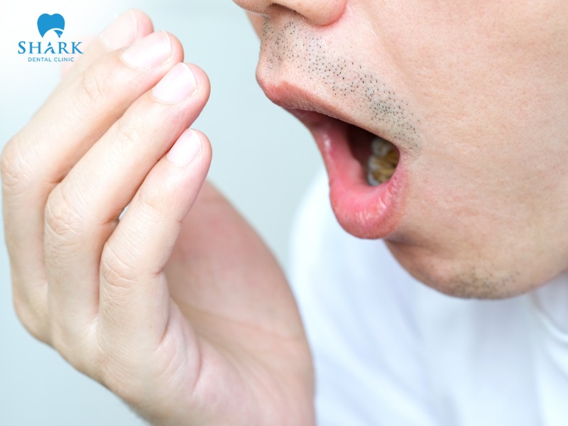 People with braces who smoke often suffer from bad breath