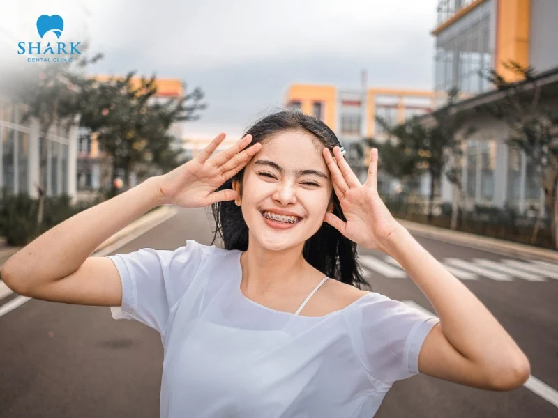 The cost of diamond braces in Vietnam typically ranges from $1500 to $4900 per treatment course