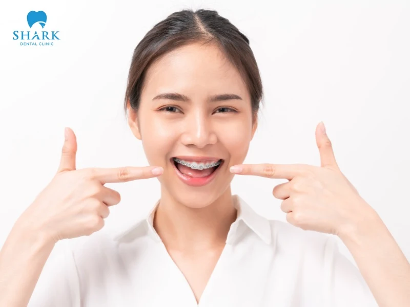 Braces can change the shape of the face, as the jaw structure is adjusted to become more balanced and harmonious