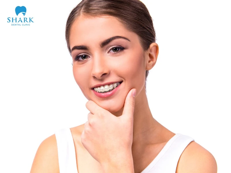 Braces make the face look more attractive, with a more confident appearance and a well-balanced jawline
