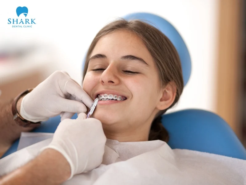 It’s important to keep a comfortable mindset and avoid excessive stress so the orthodontic process progresses as planned