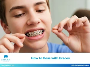 How to floss with braces