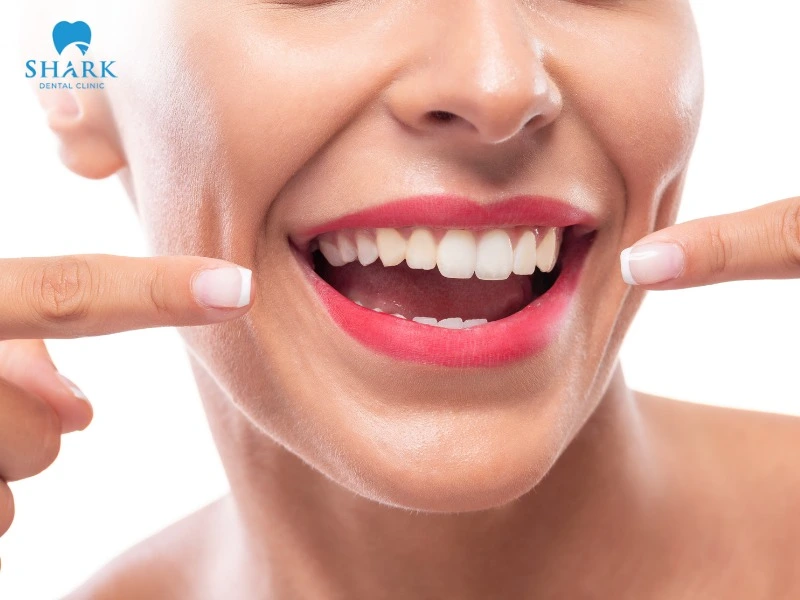 If teeth are slightly misaligned, they can be adjusted and straightened without braces