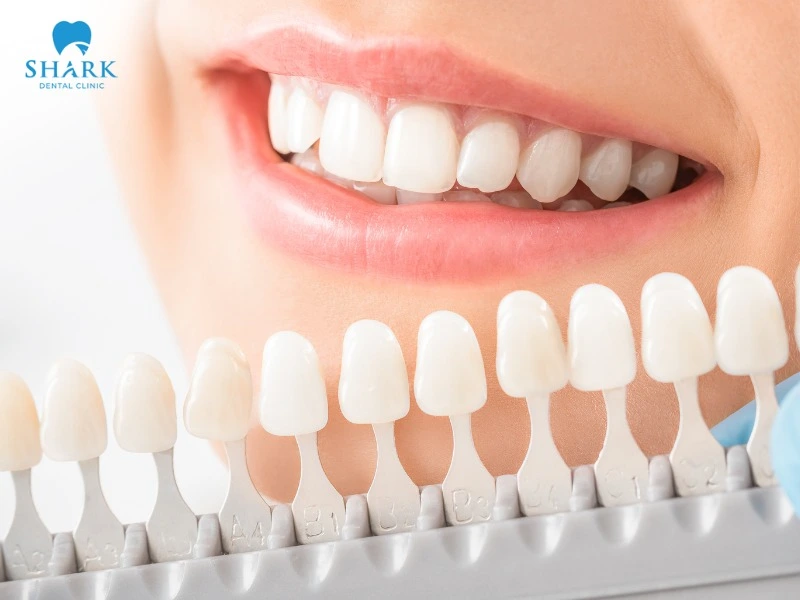 Dental crowns can effectively improve conditions where teeth are just slightly spaced, and the jawbone structure is even
