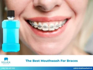 mouthwash for braces