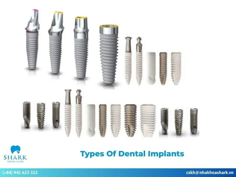 Types of dental implants