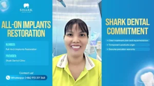 Dental Bridge Failing - the Full-Arch restoration