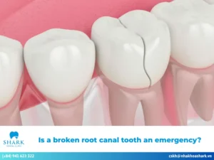 Is a broken root canal tooth an emergency?