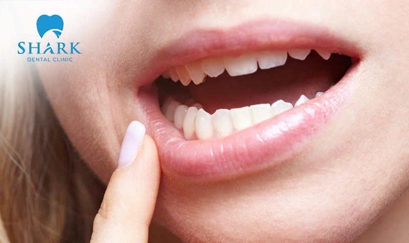 Palatal expansion is not as painful as many people think