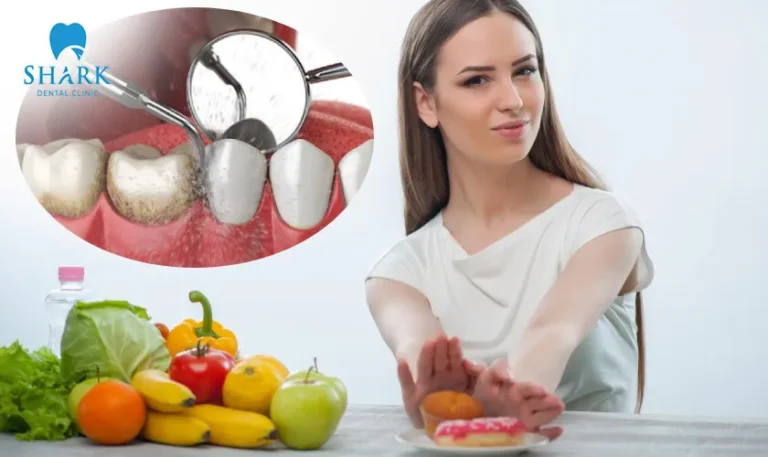 After scaling, consume soft foods and fresh fruits and vegetables to minimize impact on your teeth